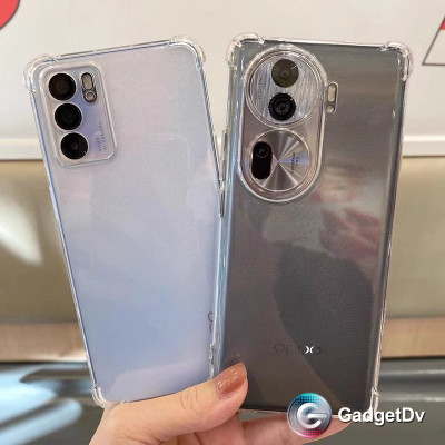 36019 Honor X8B защитная крышка-чехол, прозрачный силикон