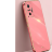 20315 Xiaomi11 защитная крышка-чехол, Глянец