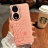 31036 Honor 70 защитная крышка-чехол, New Case