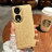 31036 Honor 70 защитная крышка-чехол, New Case